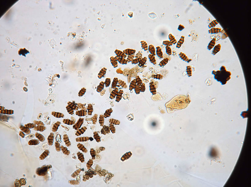 Seiridium conidia